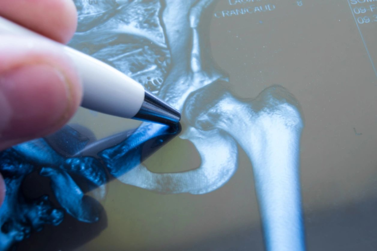 The Benefits of PRP Injection Therapy in Scottsdale for Healing and Rejuvenation