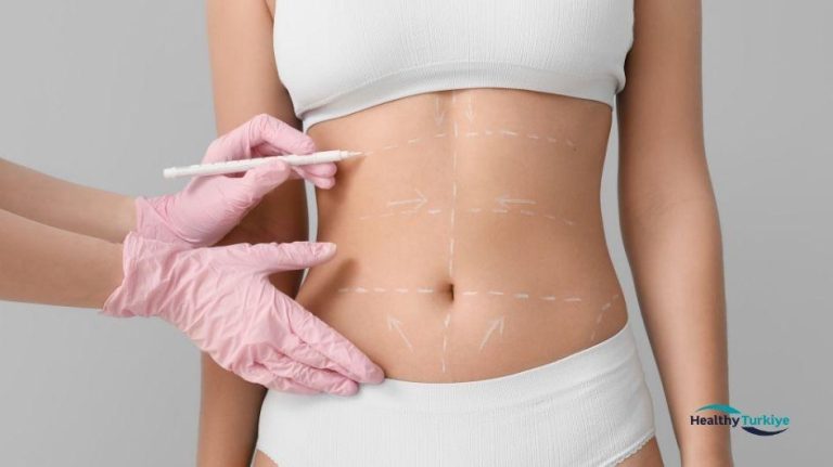Targeting Specific Areas with Tummy Tuck in Turkey